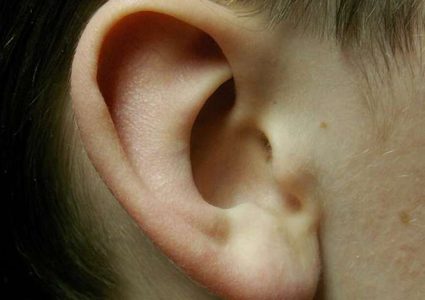 دراسة: تحفيز الأذن يساعد في السيطرة على أعراض مرض الباركنسون