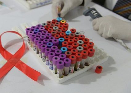 جهاز قابل للزرع "يمنع الإصابة بفيروس نقص المناعة لمدة عام"!