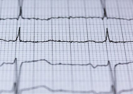 طرق تحميك من خطر الإصابة بنوبة قلبية قاتلة!