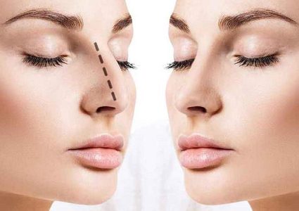 ما هي عمليات التجميل الأكثر خطورة؟