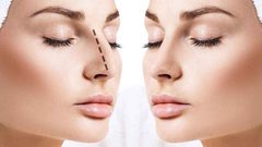 ما هي عمليات التجميل الأكثر خطورة؟