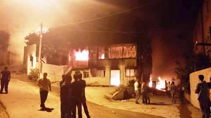 اصابة حرجة لمواطن 45 عامًا بشجار في رفيديا بمدينة نابلس