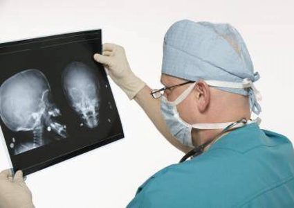 دراسة تحذر: ارتجاج الدماغ البسيط يمكن أن يفقد الإنسان حاسة الشم