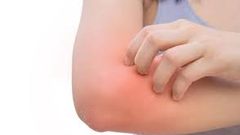 طرق علاج  الطفح الحراري في الصيف