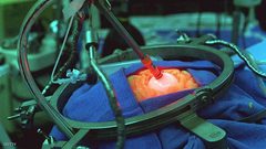 علماء يحاولون تنمية أعضاء بشرية داخل حيوانات