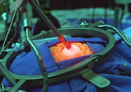 علماء يحاولون تنمية أعضاء بشرية داخل حيوانات