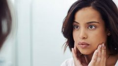 حب الشباب الهرموني ما أسبابه؟