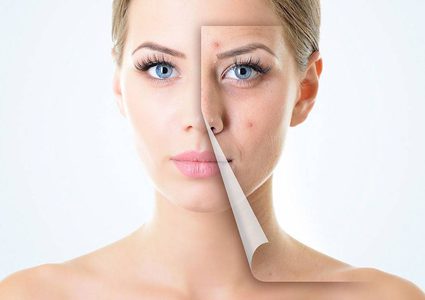 كيف تتخلصين من حبوب البشرة