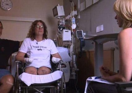 بسبب لعاب كلابها.. بتر الأطراف الأربعة لامرأة أمريكية