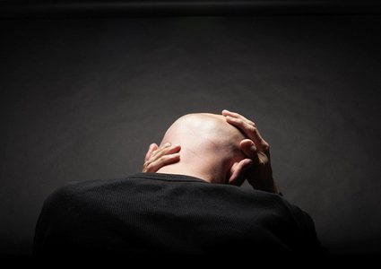 علاج رائد للصلع "ينهي" مأساة الرجال!