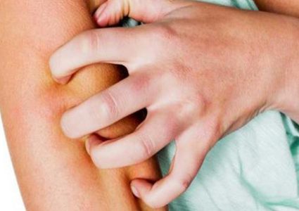 تغيرات في الجلد قد تكون اشارة للإصابة بمرض السكري