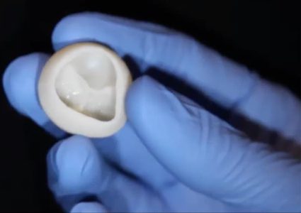 هل نجح العلماء في "طباعة" قلب من الكولاجين؟!
