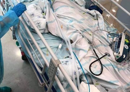 تركيب جمجمة صناعية للطفل الجريح  اشتيوي