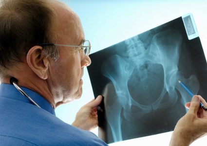 تعرف على خطورة نقص الحديد في الدم