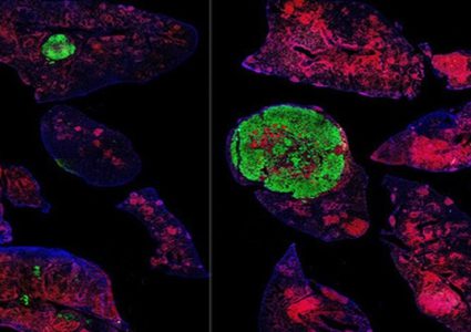طريقة جديدة لمنع الوفاة بسبب السرطان