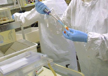 علماء يكتشفون عضو جديد يفسر الألم الذي نصاب به