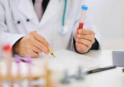 اختبار دم جديد يتنبأ بالوفاة بدقة 80%