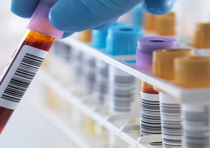 اختبار للتنبؤ باحتمال اقتراب الموت