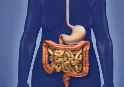 هذه هي الأعراض الرئيسية لسرطان الأمعاء