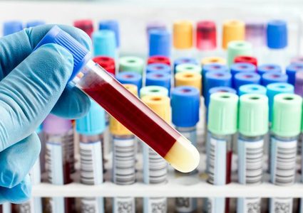 للنساء..اختبار دم جديد يكشف الإصابة بسرطان المبيض في وقت مبكر جدا