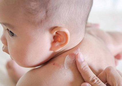 5 نصائح لعلاج الطفح الجلدى عند طفلك