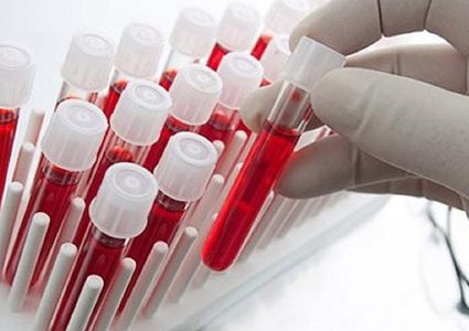 اختبار دم جديد لتشخيص الإصابة بارتجاج المخ خلال 15 دقيقة