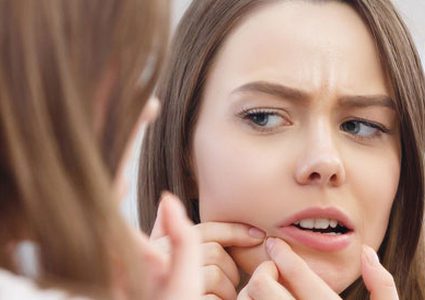 حبوب الوجه قبل الدورة الشهرية