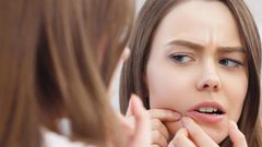 حبوب الوجه قبل الدورة الشهرية