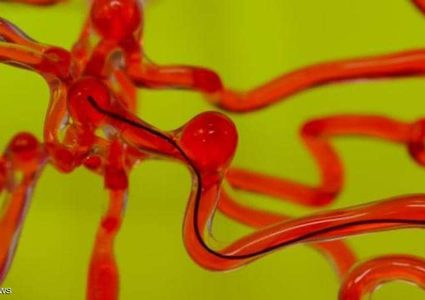 الروبوت الدودة طبيب لأدمغة البشر