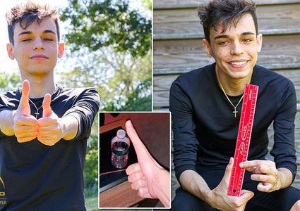 شاب يشتهر بسبب طول إبهامه