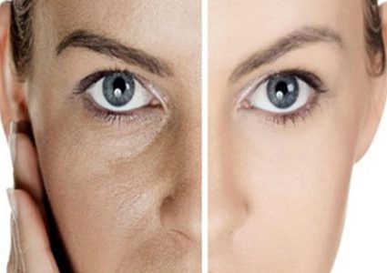 كيف تتخلصين من مسام البشرة الواسعة؟