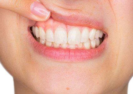 أسباب وأعراض الإصابة بحالة تورم اللثة