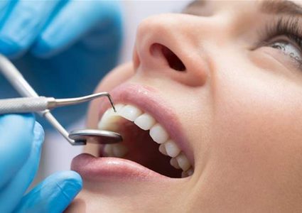 ما هي فوائد تنظيف الأسنان عند الطبيب ؟