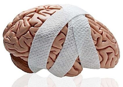 إصابة تعرض المرضى لخطر الإصابة بالخرف