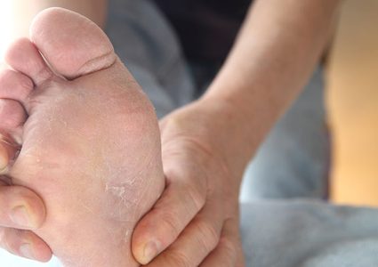 4 نصائح لحماية قدميك من الأمراض الجلدية