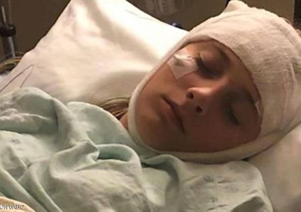 ذاكرة فتاة تعيد ضبط نفسها كل ساعتين