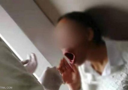 دخلت في نوبة ضحك شديدة فخلع فكها