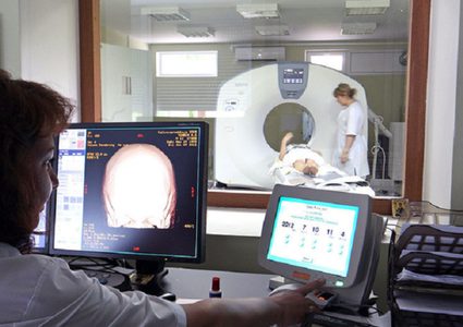 كشف الأعراض الأساسية لسرطان الدماغ