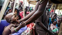 ارتفاع عدد الإصابات بالكوليرا في السودان