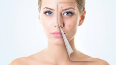 ما هي الأطعمة التي تحارب حب الشباب ؟