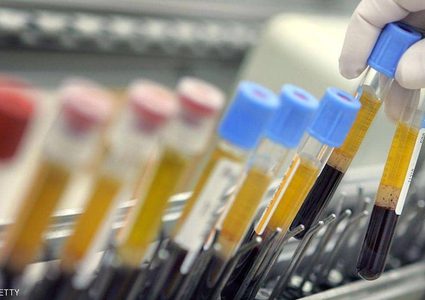 شاب يجري تجارب على نفسه