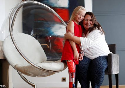 للمرة الأولى.. طفلة مبتورة ساقين "تصنع التاريخ" في عاصمة الموضة