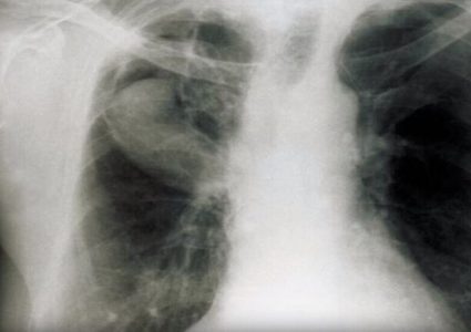 فطر يقتل كلباً ويصيب صاحبه بنوبات سعال شديدة