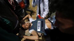 مركز حقوقي: قوات الاحتلال تتعمد استهداف الصحفيين الفلسطينيين