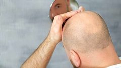 كيف يؤثر التوتر والإجهاد على صحة الشعر؟