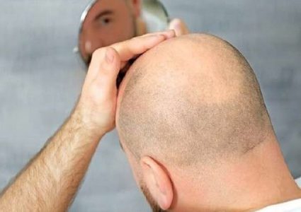 كيف يؤثر التوتر والإجهاد على صحة الشعر؟