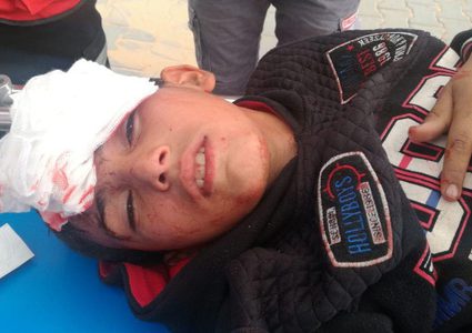 إصابات جراء قمع الاحتلال لمسيرات العودة شرق غزة