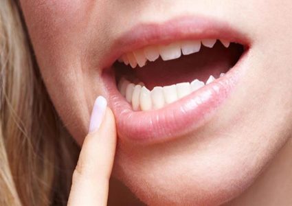 أبرز أسباب المعاناة من مشكلة تورم اللثة