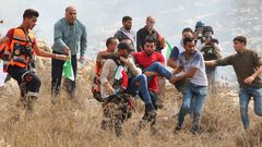 اصابة الزميل مروان الأغبر خلال مشاركته بمسيرة سلمية شمال رام الله