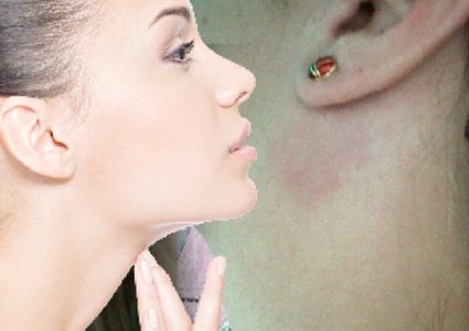 تعرفوا على أبرز أسباب تورم الغدد الليمفاوية